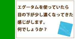 目の下が濃くなった気がするのですが・・・